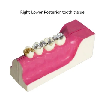 Dentar Inferior Drept Descompunere Modelul Dinte Molar Secțiune Transversală Boala Parodontala Predare Student Dinți Stomatologie Terapie